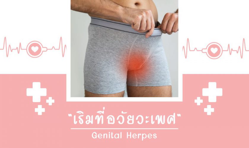 เริมที่อวัยวะเพศ Genital Herpes