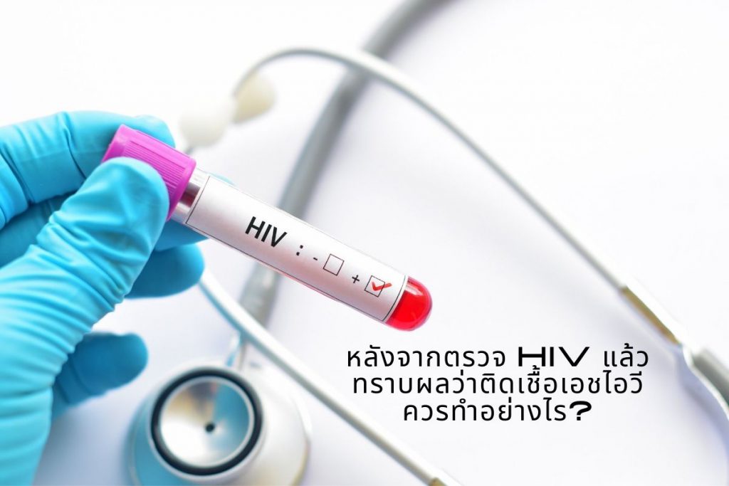 หลังจากตรวจ HIV แล้วทราบผลว่าติดเชื้อเอชไอวีควรทำอย่างไร
