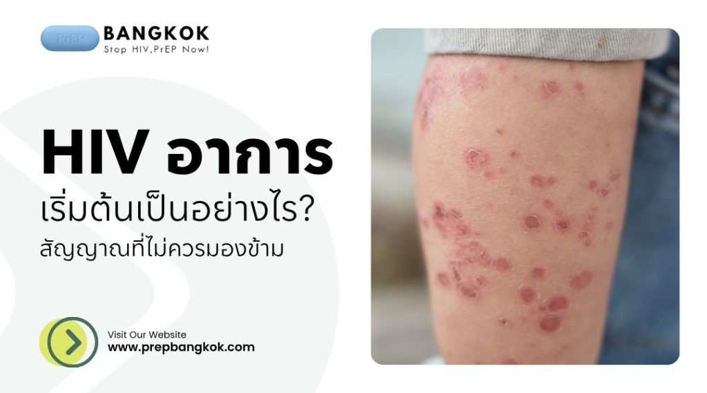 HIV อาการ เริ่มต้นเป็นอย่างไร สัญญาณที่ไม่ควรมองข้าม