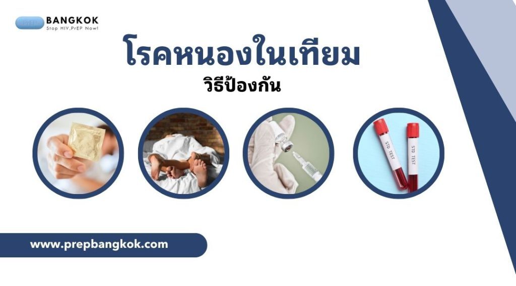 วิธีป้องกัน โรคหนองในเทียม