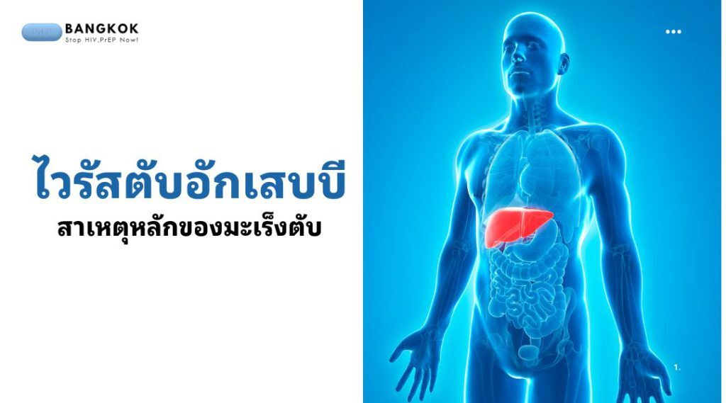 ไวรัสตับอักเสบบี (Hepatitis B Virus) สาเหตุหลักของมะเร็งตับ