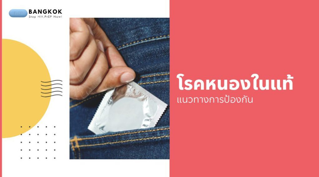แนวทางการป้องกัน โรคหนองในแท้