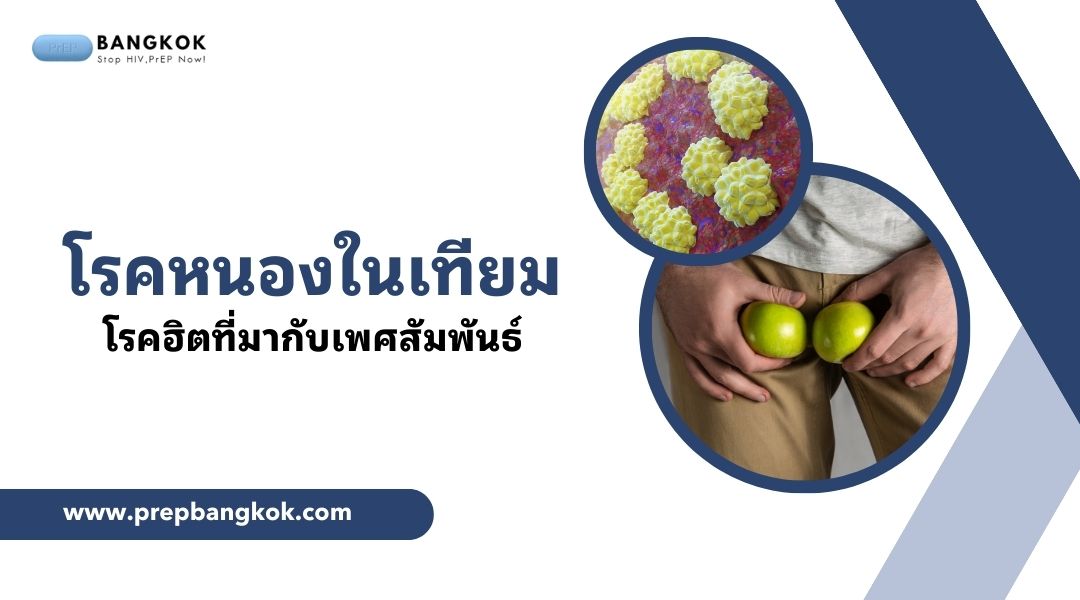 โรคหนองในเทียม (Chlamydia) โรคฮิตที่มากับเพศสัมพันธ์